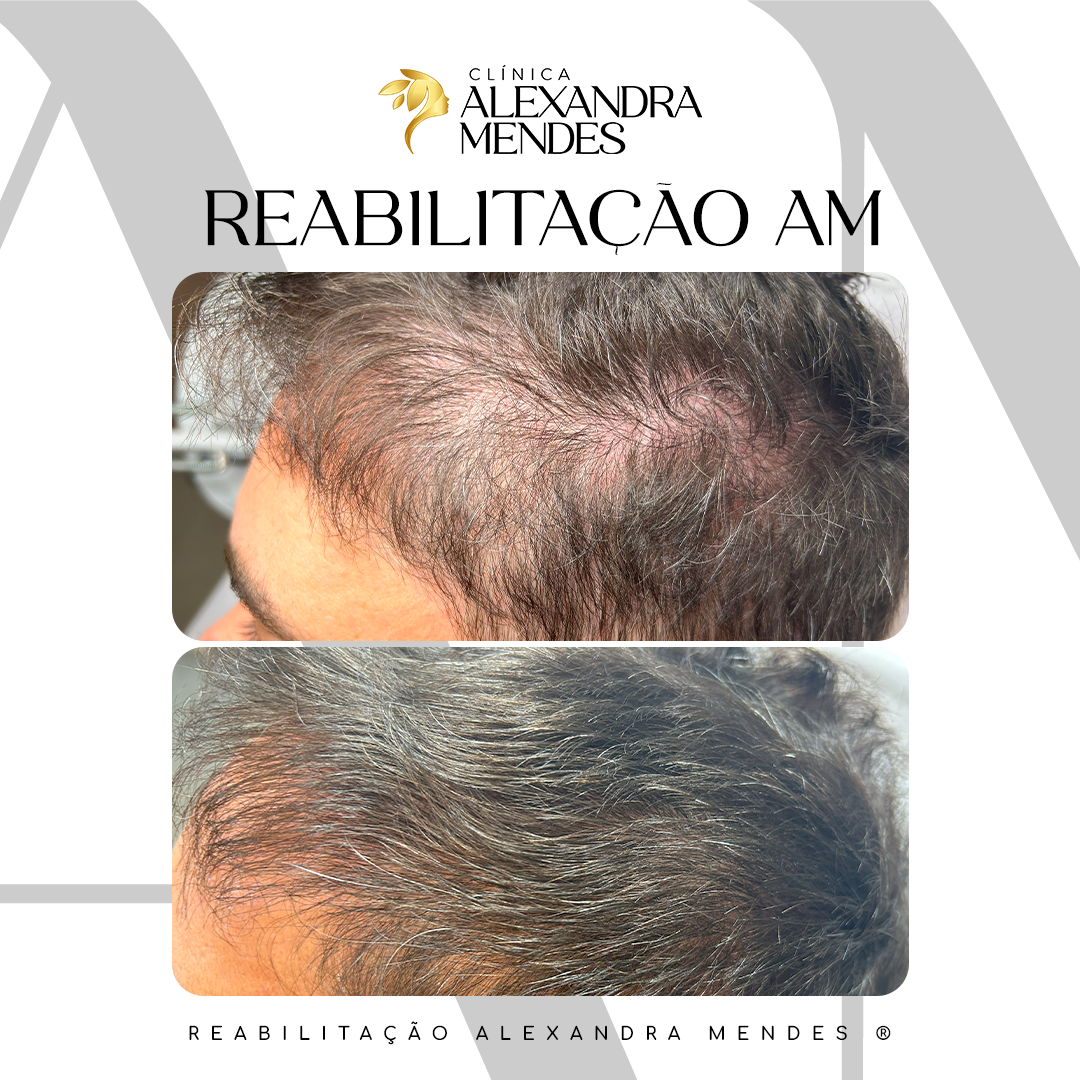 CASO 03