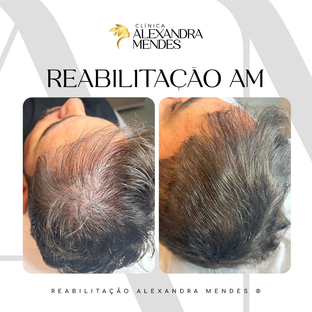 CASO 04