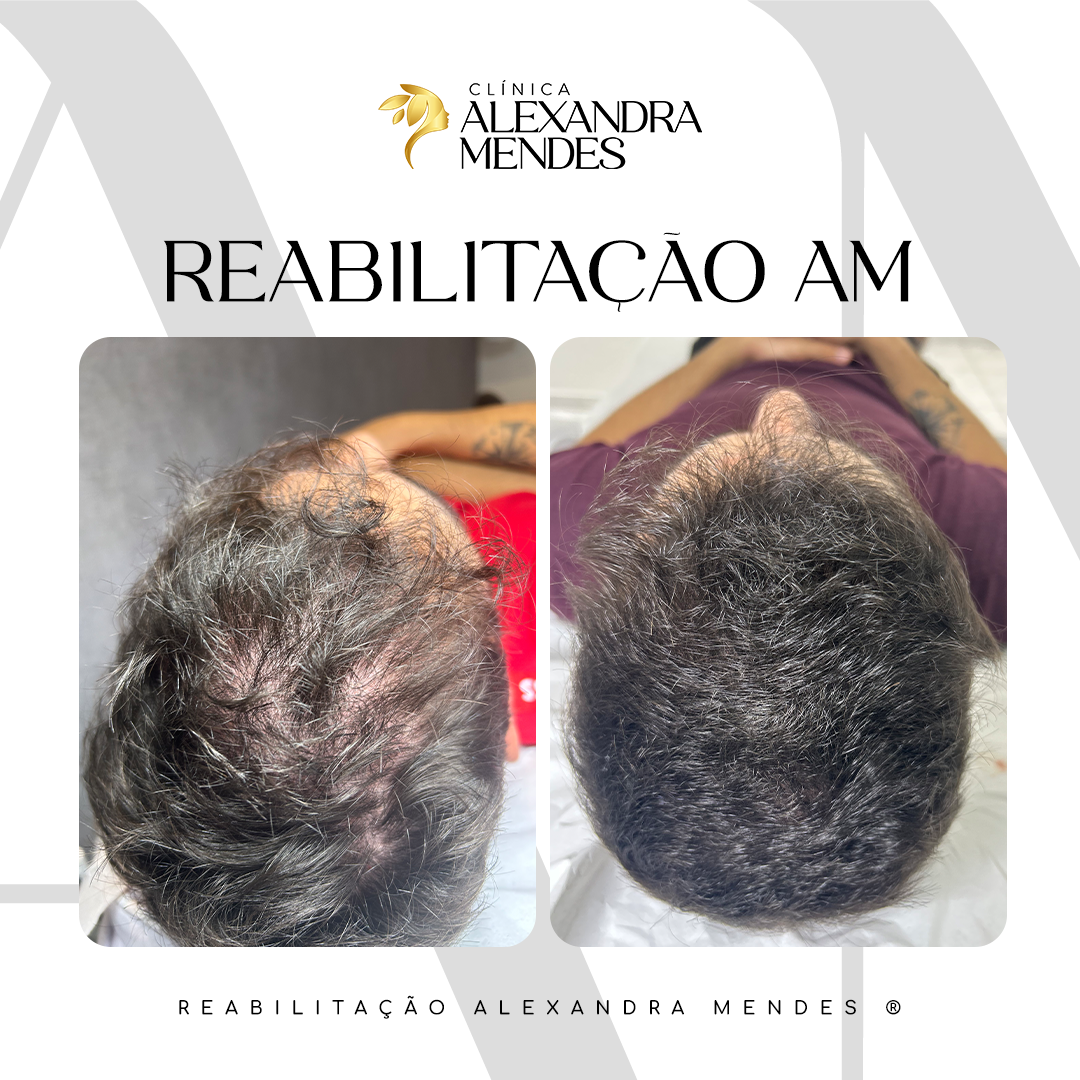 CASO 16